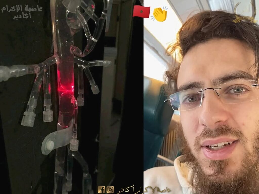 التفاصيل الكاملة لآخر خرجة للدكتور العزوزي مخترع جهاز تصفية الدم من داخل الاوعية الدموية بعد الهجوم الشرس عليه .